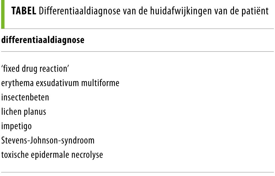 Een ‘fixed drug reaction’ bij gebruik van paracetamol NTVG