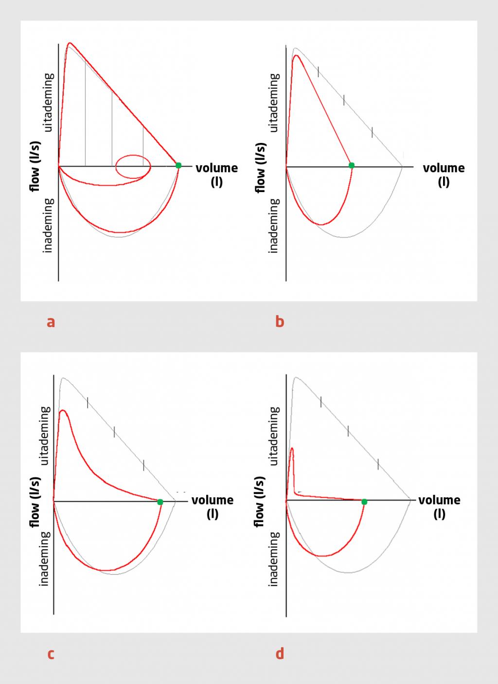 Figuur 1 | Voorbeelden van flow-volumecurves