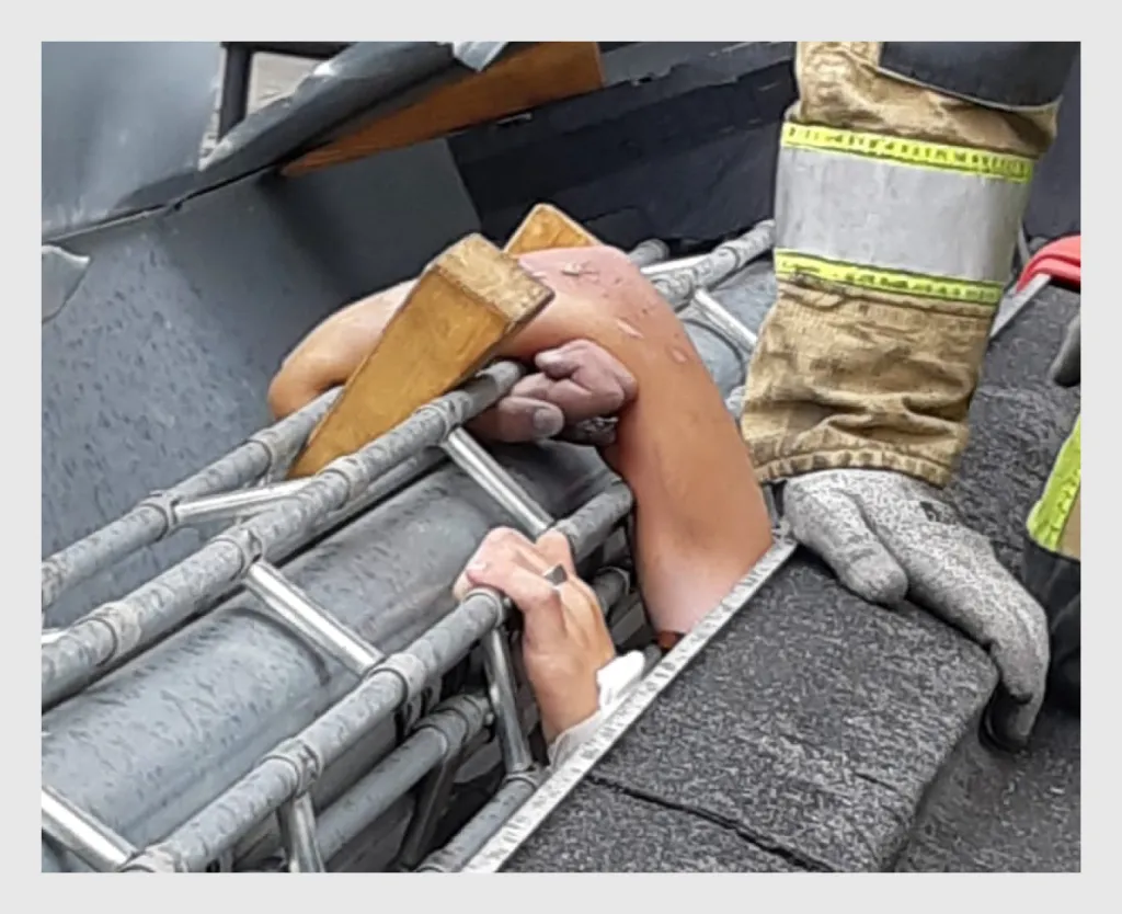 Figuur 1 | Rechter arm bekneld in een roldeur