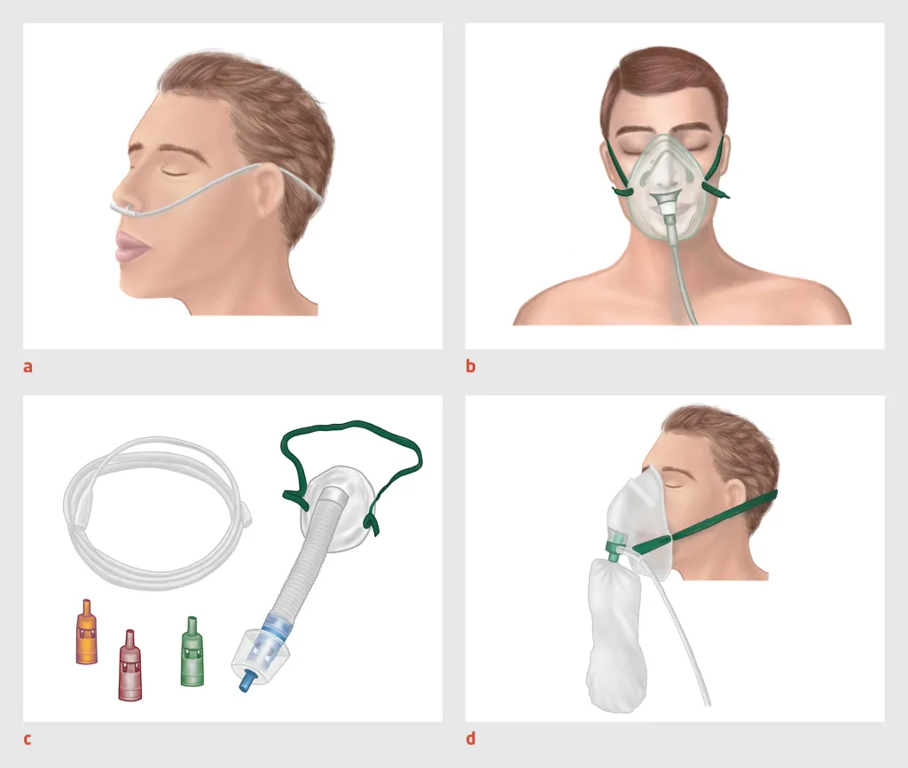 Figuur 1 | Zuurstoftoediening met lage flow