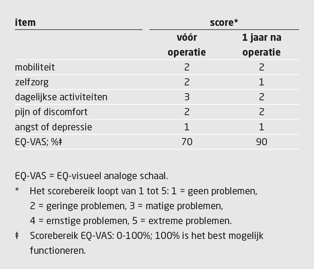Tabel 1 | EQ-5D-score van de patiënte die dubbelzijdige handtransplantatie onderging | Vergelijking van resultaten vóór operatie met 1 jaar na operatie