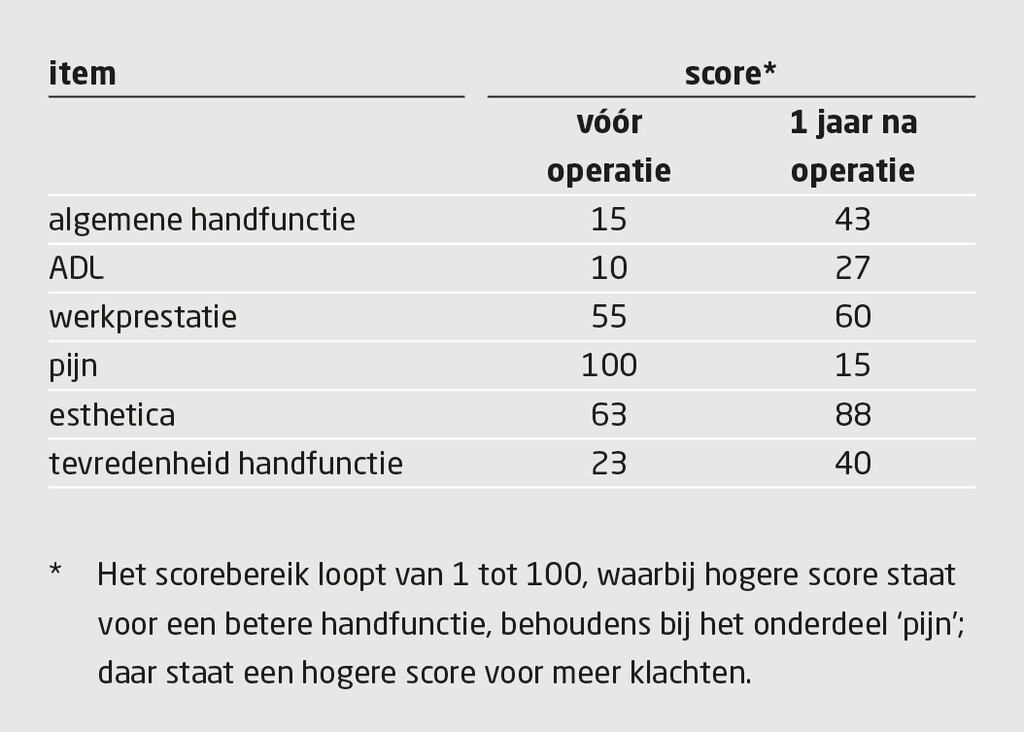 Tabel 2 | Score op de Michigan Hand Outcome Questionnaire (Nederlandse versie) van de patiënte die dubbelzijdige handtransplantatie onderging | Vergelijking van resultaten vóór operatie met 1 jaar na operatie