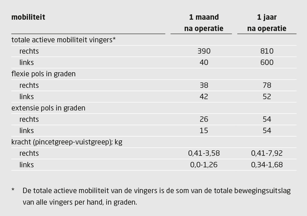 Tabel 3 | Actieve beweeglijkheid van de handen van patiënte die dubbelzijdige handtransplantatie onderging | Resultaten van 1 maand en 1 jaar na operatie