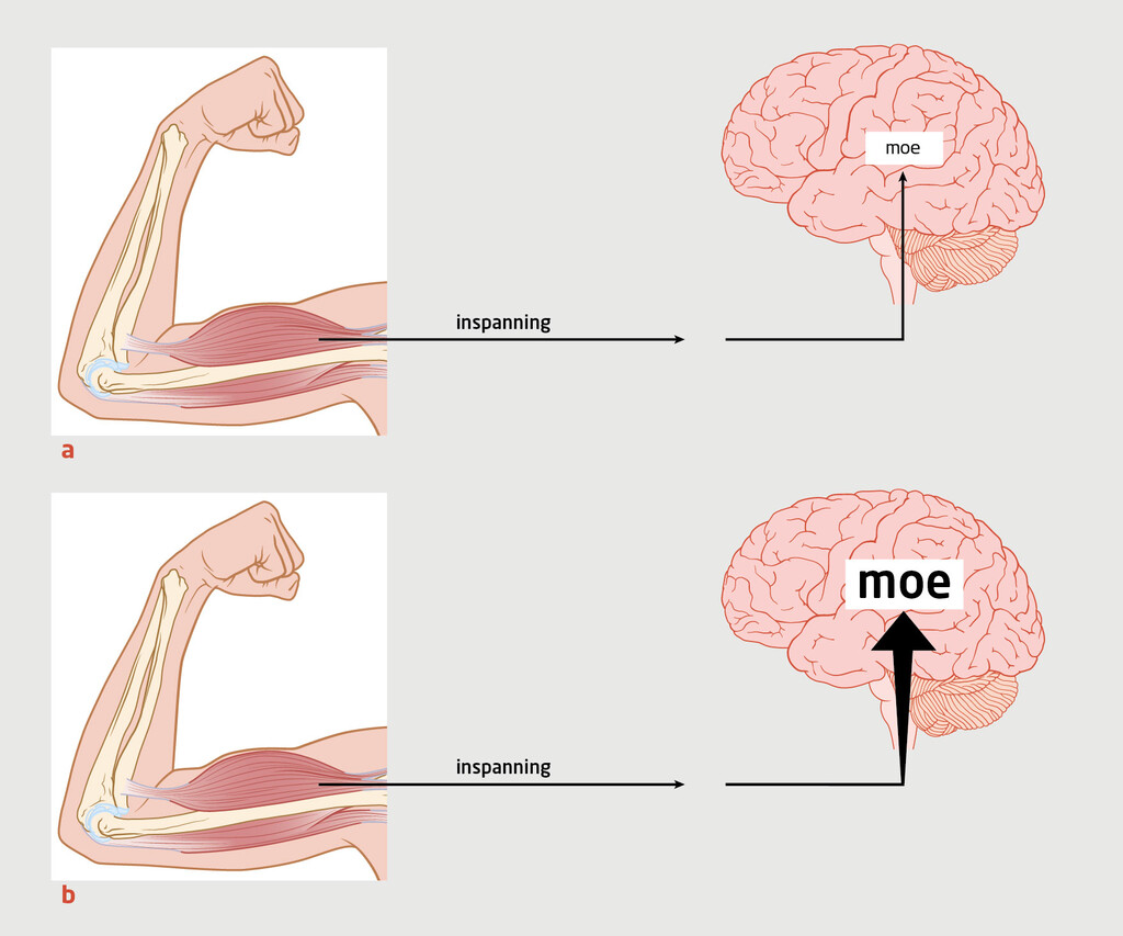 Figuur 2 | Ziekteperceptie bij het chronische-vermoeidheidssyndroom