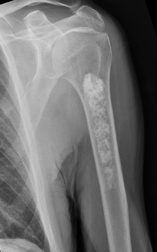 röntgenfoto van de arm
