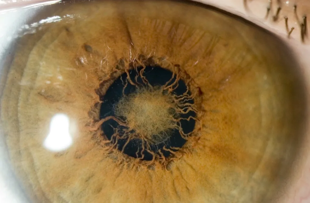 foto van het oog