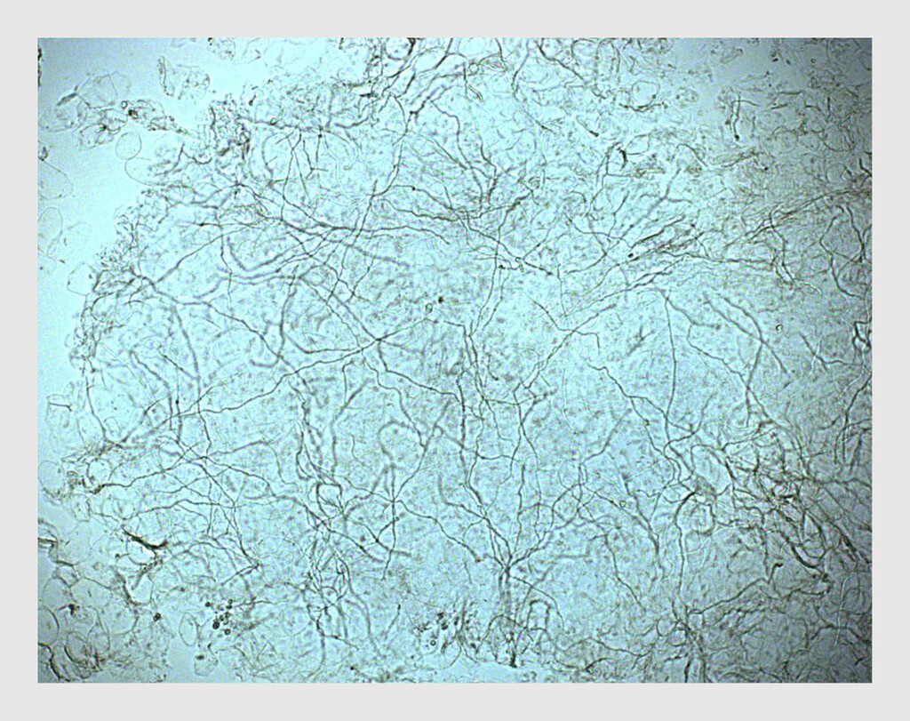 Figuur 3 | Schimmeldraden in KOH-preparaat