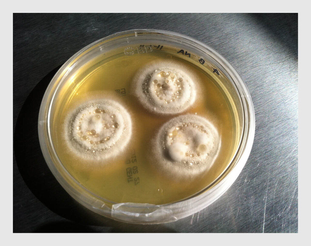 Figuur 4 | Positieve schimmelkweek