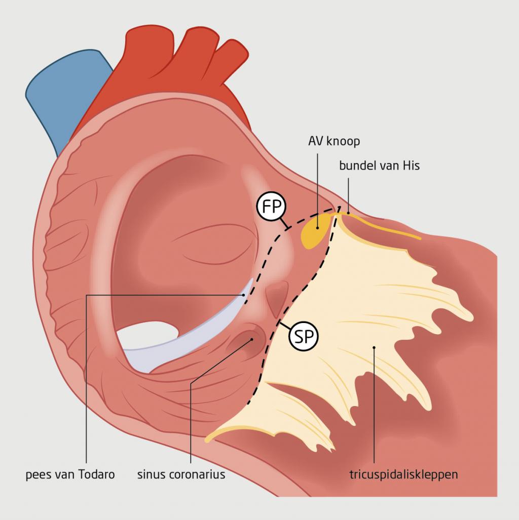 Figuur 3 | De anatomie van de driehoek van Koch in het hart