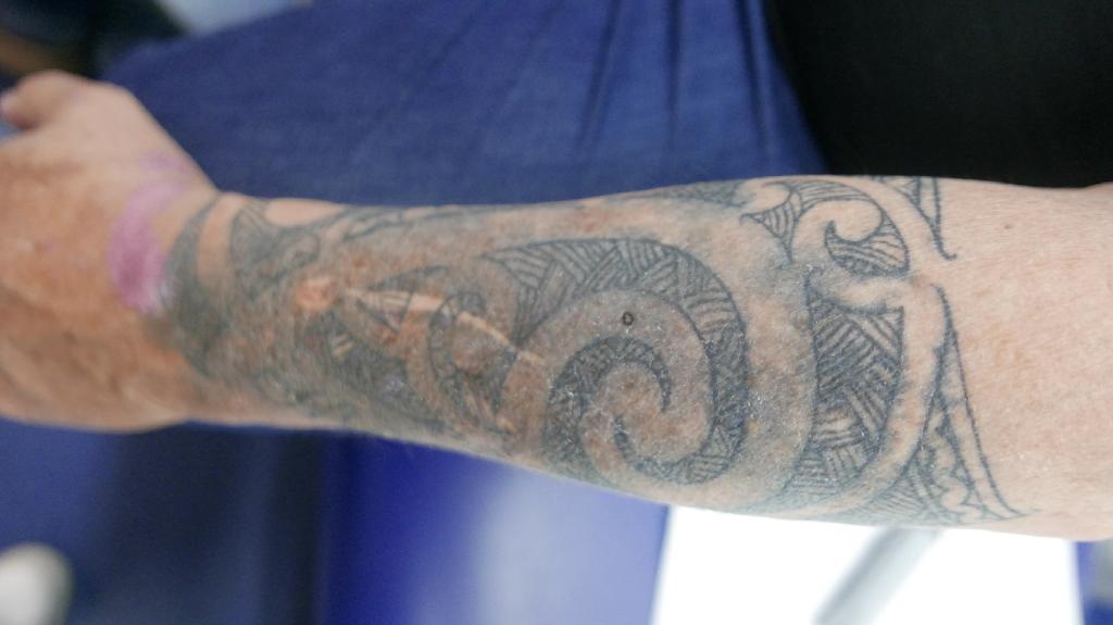 onderarm waarop een tatoeage te zien is die aan het verkleuren is.