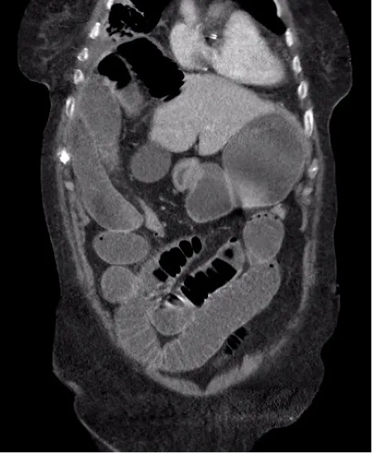Radiologisch figuur van de romp.