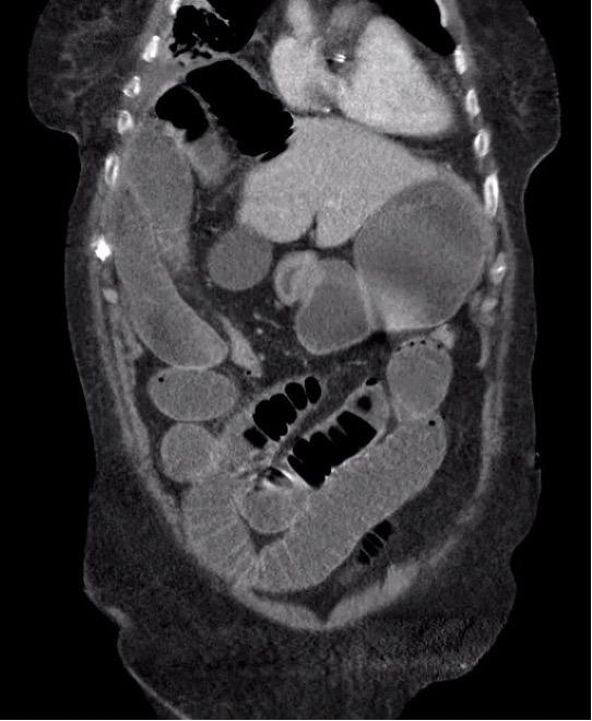 Radiologisch figuur van de romp.