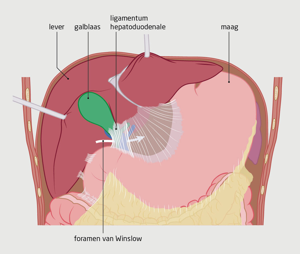 Figuur 1 | Het foramen van Winslow