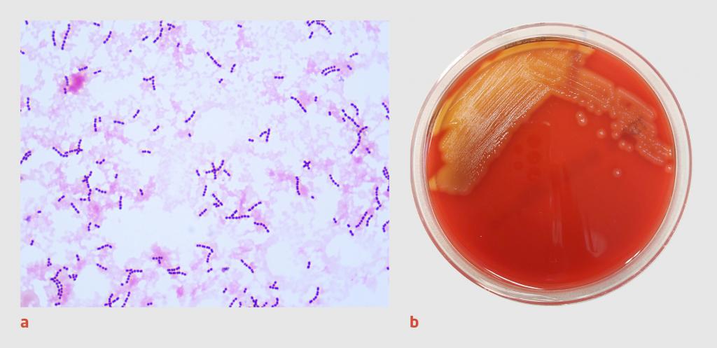 Figuur 4 | Microbiologische diagnostiek
