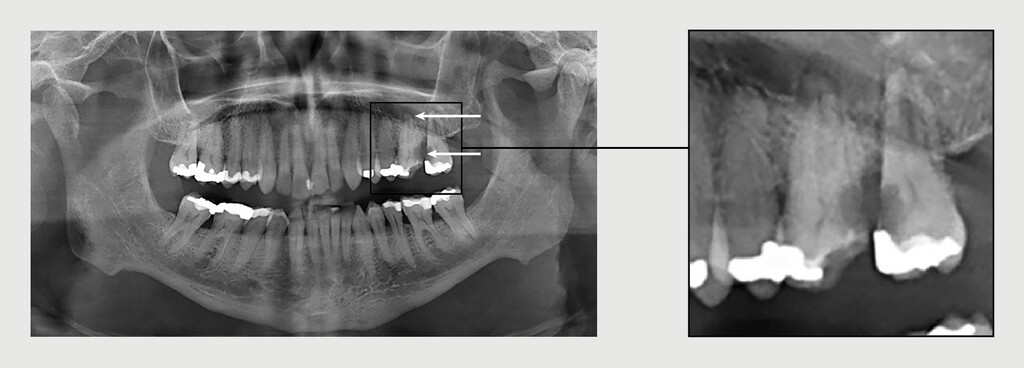 Figuur 3 | Orthopantomogram