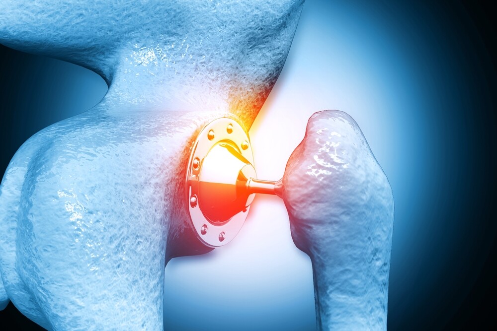 Illustratie van het kogelgewricht van de schouder