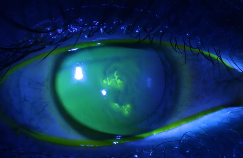 Foto van oog
